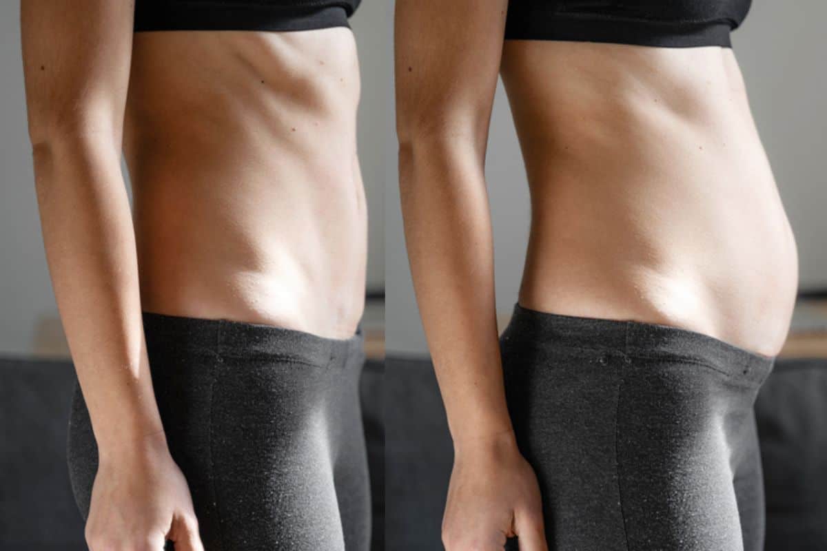 How long does diastasis recti take to improve Oldham?