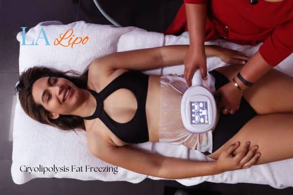 woman getting cryolipolysis Oldham
