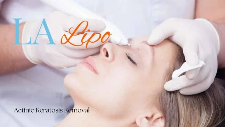 Woman receiving Actinic Keratosis Removal Treatment Oldham