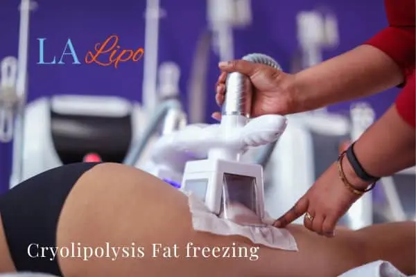 women getting fat freezing Oldham