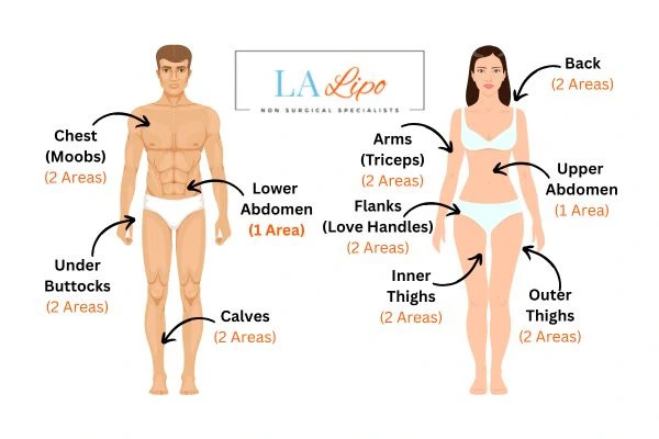 LA LIPO Cryolipolysis Areas Oldham