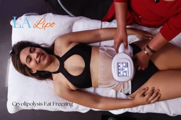 woman getting cryolipolysis Oldham