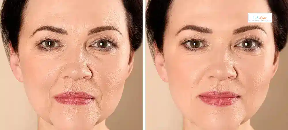 How Long Does It Take to See Results and How Long Do They Last Oldham?
