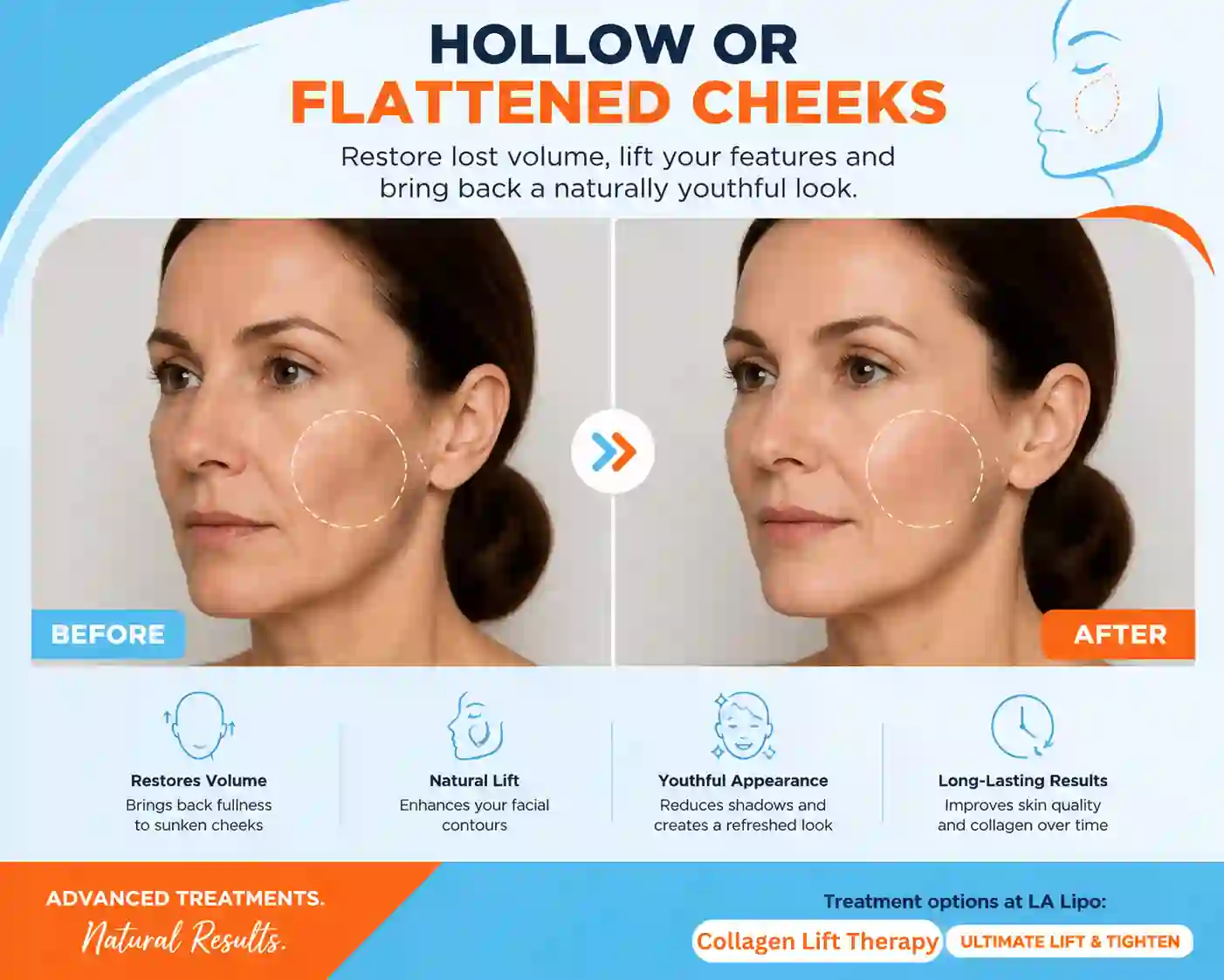 Sign #4: Hollow or Flattened Cheeks Oldham