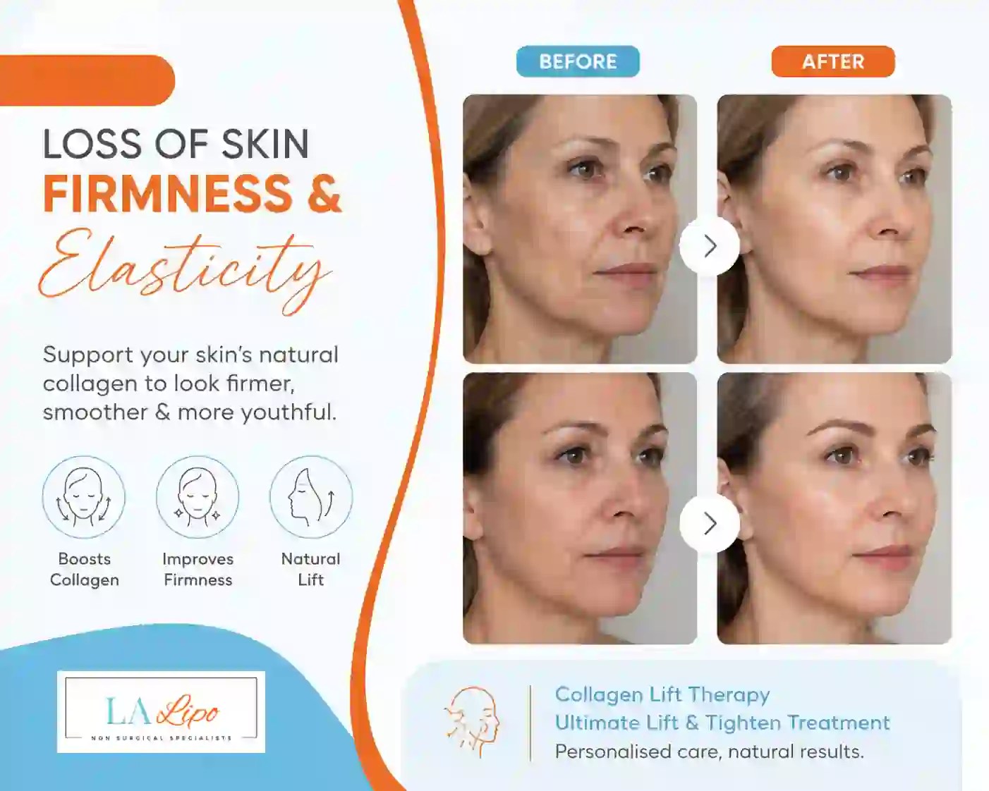 Sign #7: Loss of Skin Firmness and Elasticity Oldham